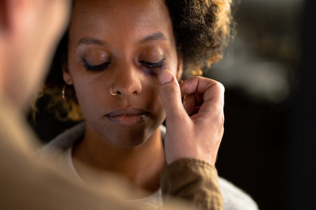 A Person Touching a Woman's Eye with a  Bruise